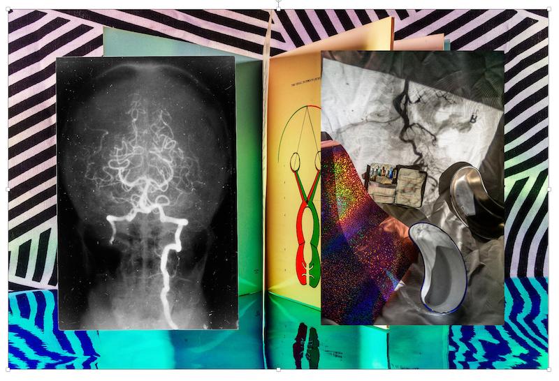 Collage of black and white medical imagery and pop-art colored patterns.
